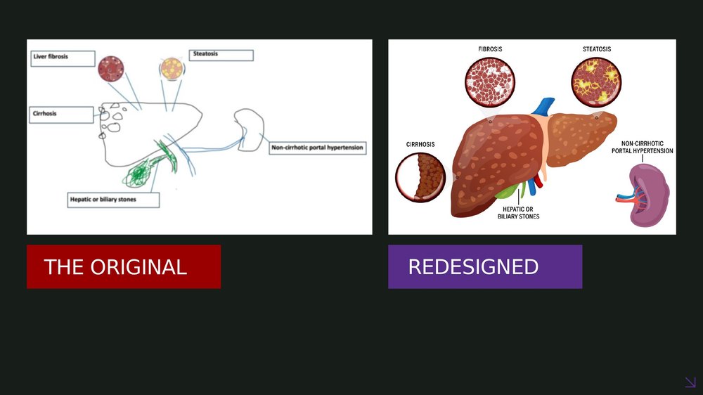 Cystic fibrosis diagram redesign, before and after
